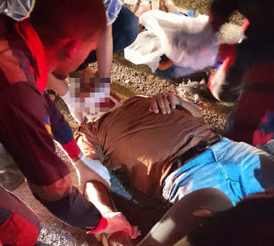 Homem sofre fratura exposta após batida entre carro e moto em Conceição do Coité 