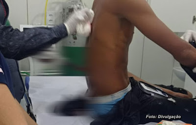 Santaluz:Adolescente de 13 anos é socorrido para hospital com faca cravada nas costas após confusão em bar